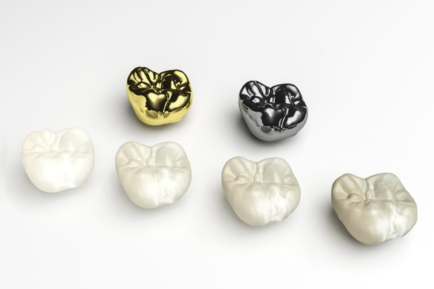 Which Dental Crown Material Is Best All Smiles Dentistry