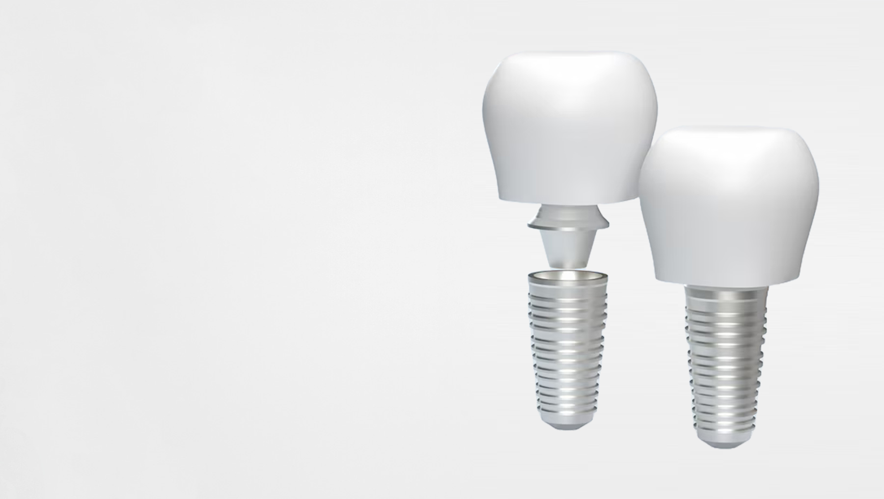 dental implants - perfect options for tooth replacement